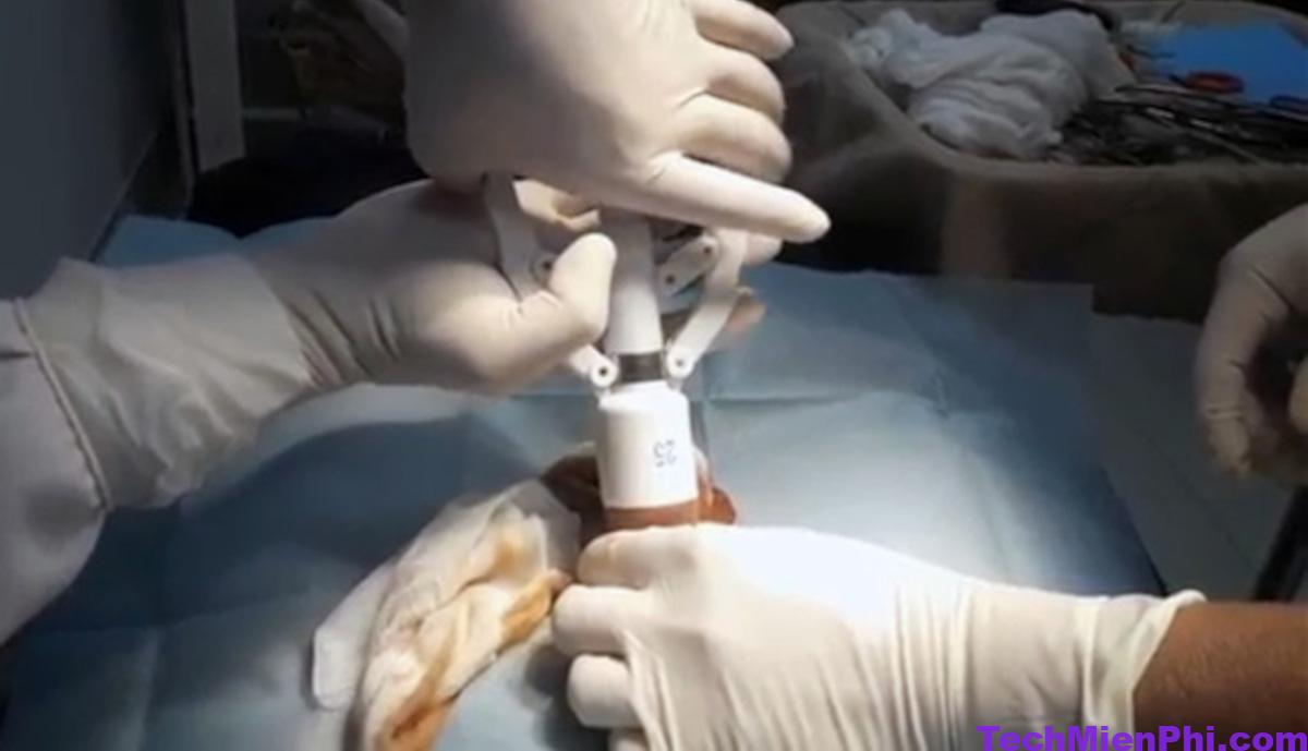 Cắt bao quy đầu là gì? Top 5 máy cắt bao quy đầu tốt nhất hiện nay